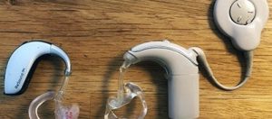 What 's the Difference Between A Cochlear Implant and A Hearing Aid
